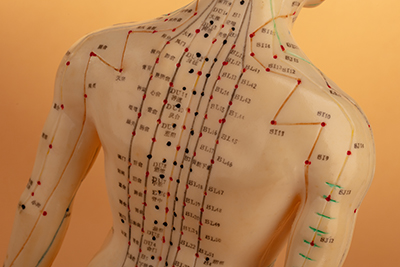 Acupuncture Banbury